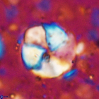 Braarudosphaera turbinea 6699