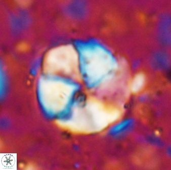 Braarudosphaera turbinea 6699