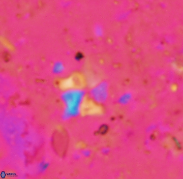 Bukryaster hayi 1117