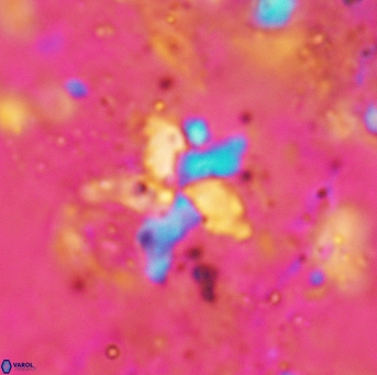 Bukryaster hayi 5170