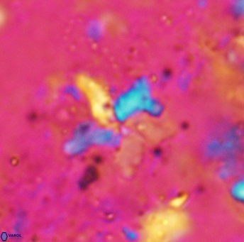 Bukryaster hayi 5172