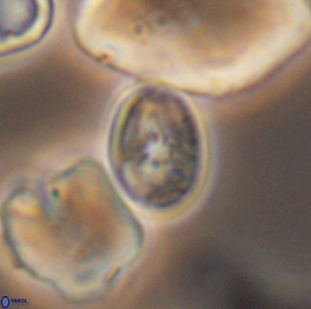 Bukrylithus ambiguus 9314