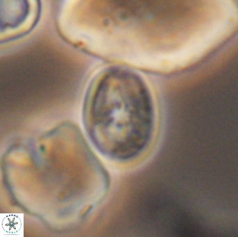 Bukrylithus ambiguus 9314