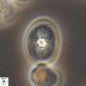 Bukrylithus ambiguus 9335