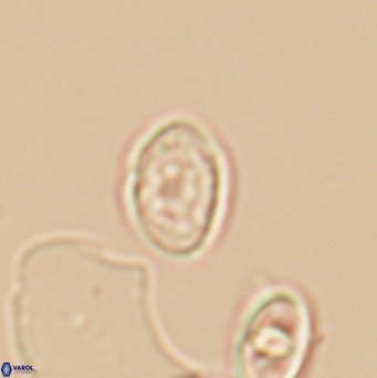 Bukrylithus ambiguus 12853