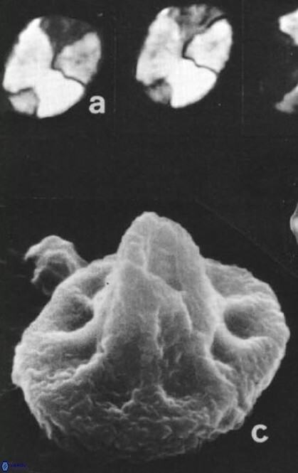 Calculites additus 5487