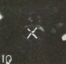 Chiastozygus amphipons 3024