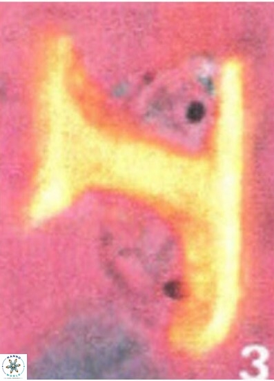 Ceratolithina bicornuta 17595