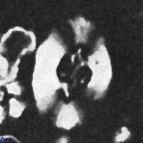 Cruciellipsis cuvillieri cuvillieri 3482