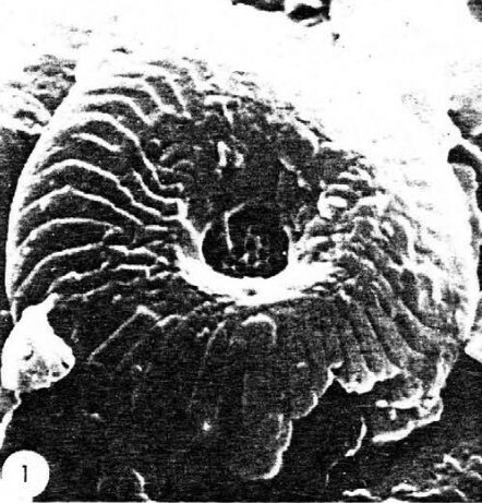 Cycloperfolithus carlae default