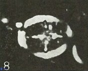 Cretarhabdus conicus 9851