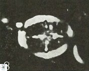 Cretarhabdus conicus 9851