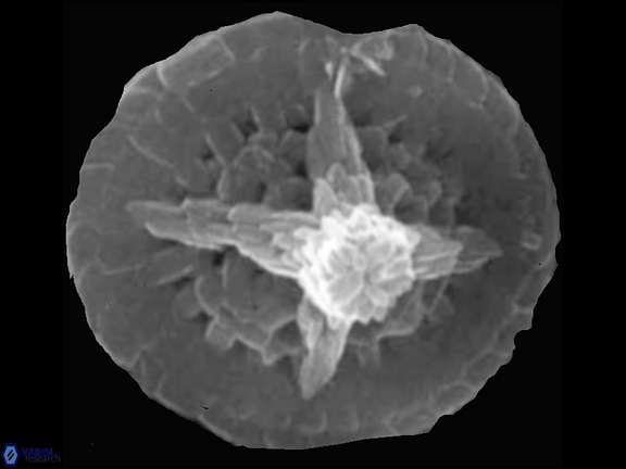 C conicus mutterlosa SEM a