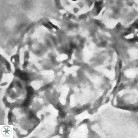Cyclagelosphaera deflandrei 3811