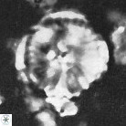 Cyclagelosphaera deflandrei 3811
