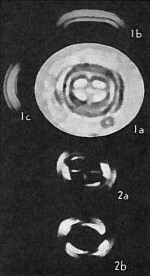 Campylosphaera dela VR 02392