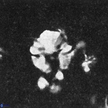 Cribrocorona echinus 13861