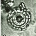 Coccolithus formosus 24028