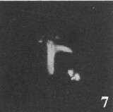 Ceratolithina hamata falcata 9348