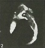 Ceratolithina hamata hamata 9490