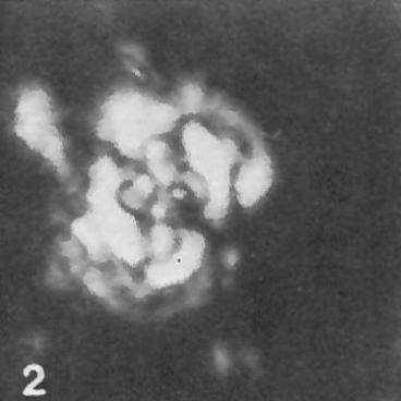 Cruciplacolithus intermedius 50969