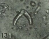 Ceratolithoides kamptneri 1661