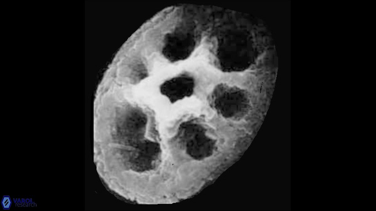 C koilos Hattner SEM a