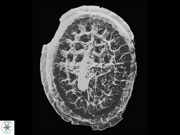 C limbicrassus Black SEM a