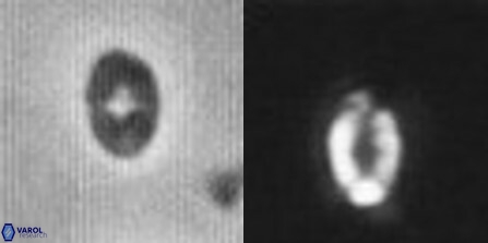 Crepidolithus parvulus 11199