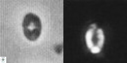 Crepidolithus parvulus 11199