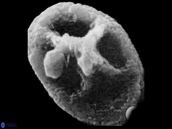 C rhachis Hattner SEM a