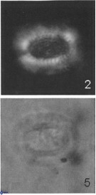 Gaarderella santacruzensis 9675