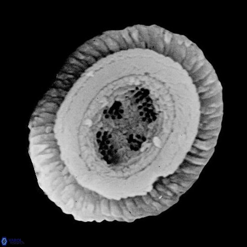 C solitus 1 A
