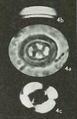 Chiasmolithus edentulus 20189