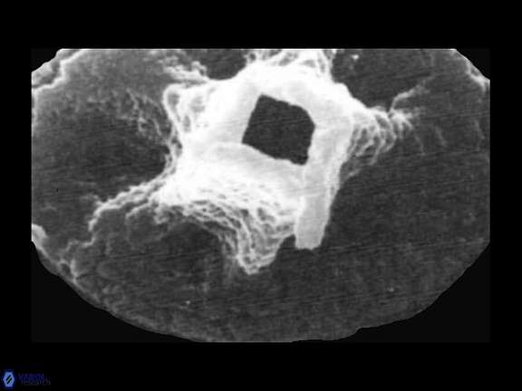 C tetraplevros Tetraplevros Farhan SEM a