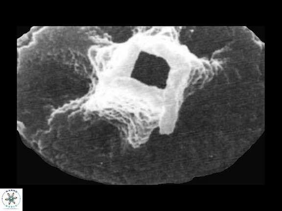 C tetraplevros Tetraplevros Farhan SEM a