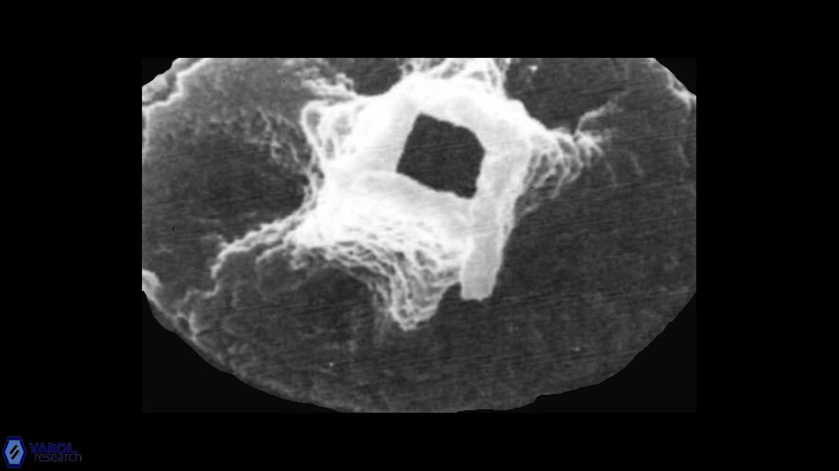 C tetraplevros Tetraplevros Farhan SEM a