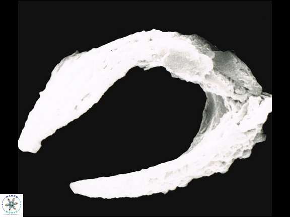 C rugosus 1