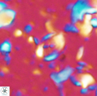 Camuralithus pelliculathus 14638