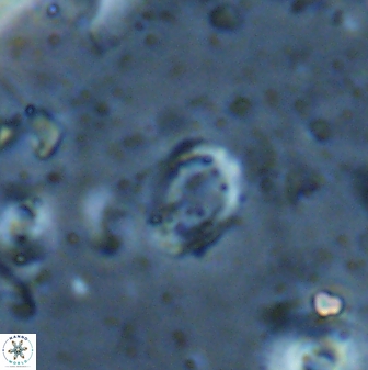 Camuralithus pelliculathus 27913