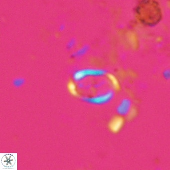 Camuralithus pelliculatus VR 028516