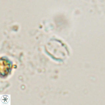 Camuralithus pelliculatus VR 028525