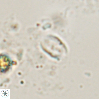 Camuralithus pelliculatus VR 028526