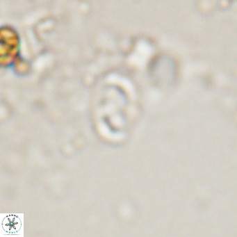 Camuralithus pelliculatus VR 028527