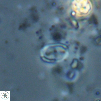 Camuralithus pelliculatus VR 028532