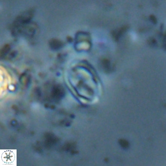 Camuralithus pelliculatus VR 028536