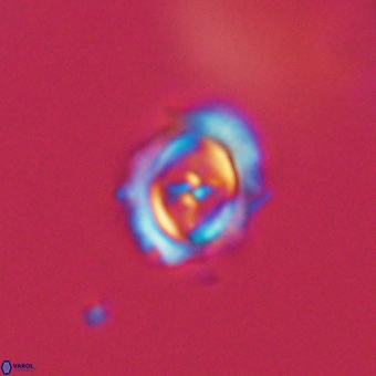 Campylosphaera cf eodela 68369