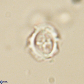 Campylosphaera cf eodela 68375