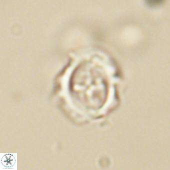 Campylosphaera cf eodela 68375