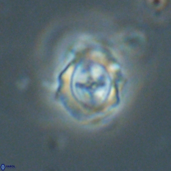 Campylosphaera cf eodela 68377